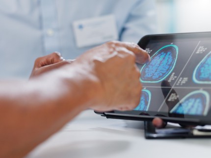 Ärzte mit MRT-Bildern des Gehirns